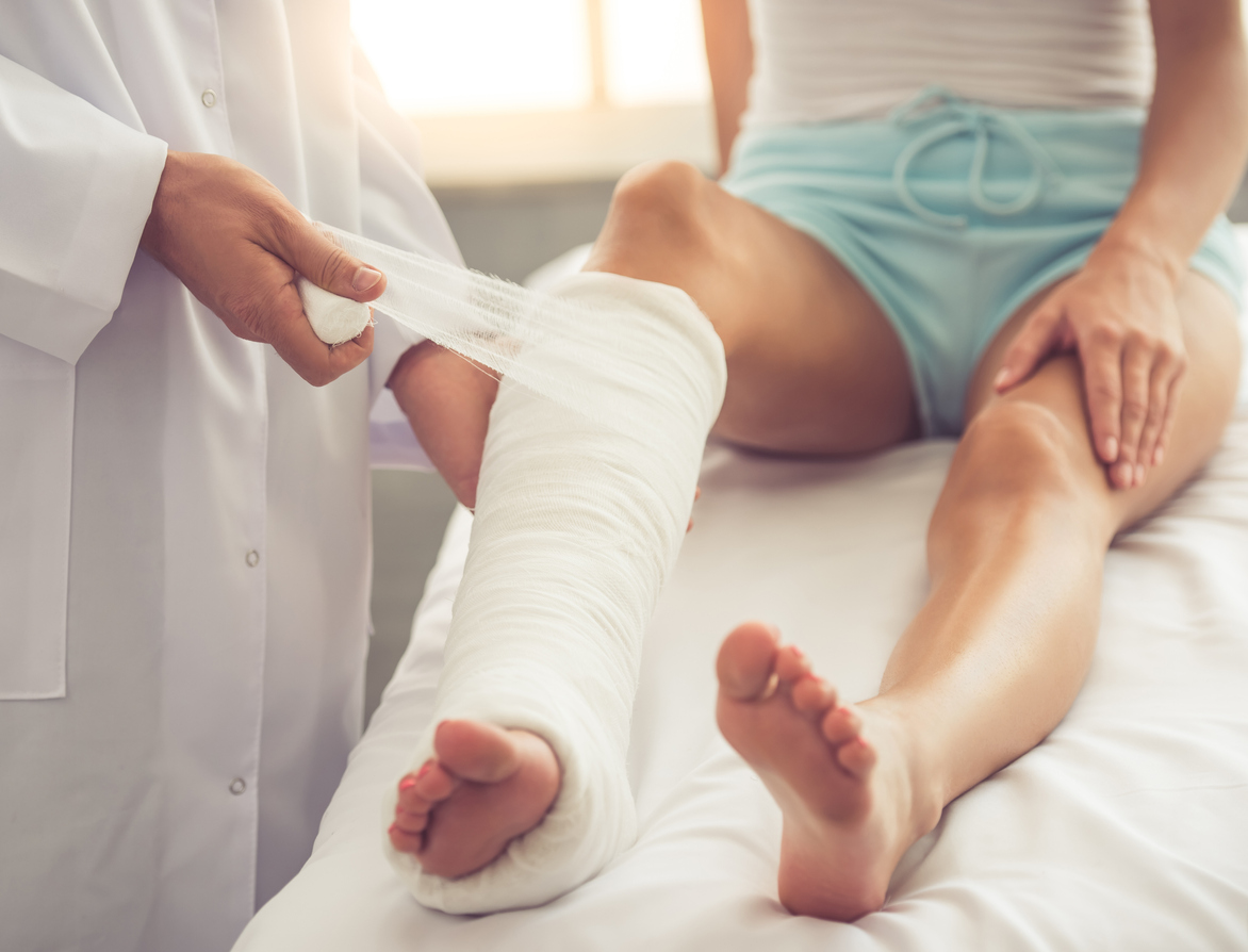 Broken Bones - Rolo Law Personal Injury Lawyers